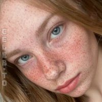 Alaskafreckles Alaskafawn Meztelen