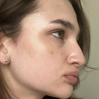Anokhina Liza Meztelen