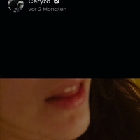 Ceryza Meztelen