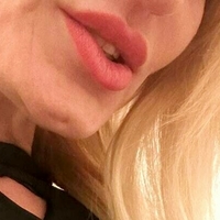 Claudia Milkers Meztelen