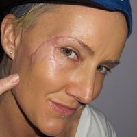 Keala Kennelly Meztelen
