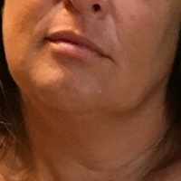 Lady Lara Meztelen