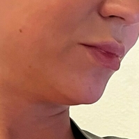 misslobatox Meztelen